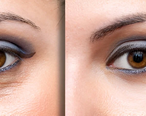 3-Steps-to-Conceal-Dark-Under-Eye-Circles