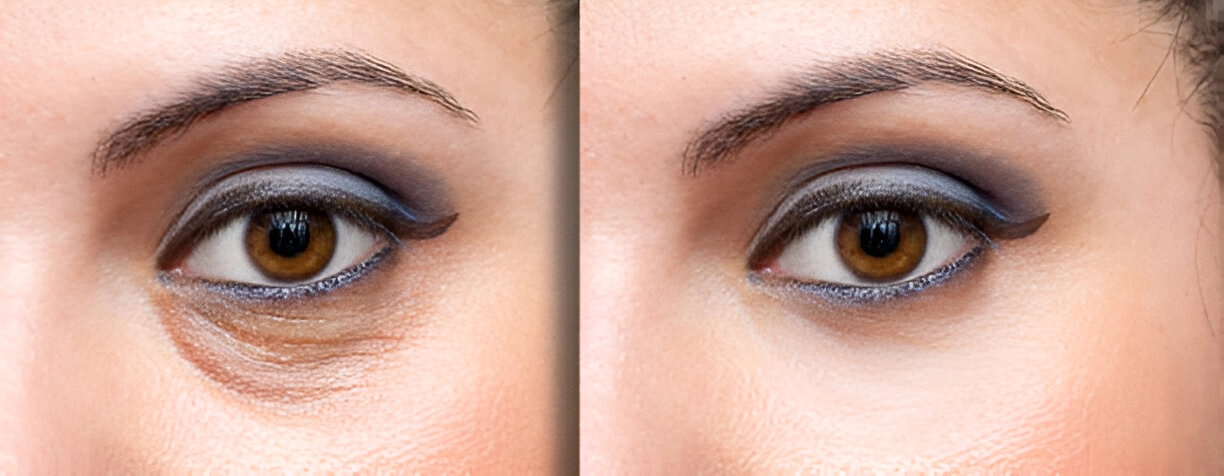 3-Steps-to-Conceal-Dark-Under-Eye-Circles