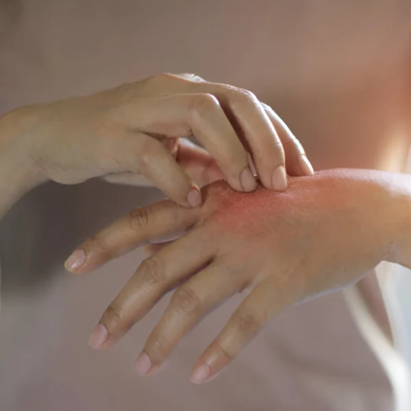 7 Easy Tips and Hacks to Hide Allergy…